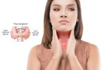 The Hypothyroidism Solution: A Comprehensive Guide