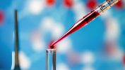 Does Hemochromatosis Help Manage Iron Levels?