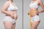 How SuperThin aids in weight loss