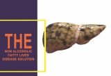 Non Alcoholic Fatty Liver Disease Solution NAFLD treatment plan