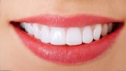 Renew Dental Support for improving oral health
