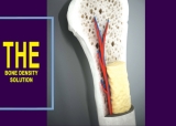 The Bone Density Solution Review: A Natural Approach to Preventing and Reversing Osteoporosis