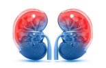 The Kidney Disease Solution Program Review: A Comprehensive Analysis