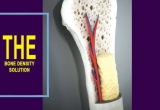 The role of Osteoporosis – Bone Density Solution in bone health.