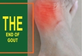 Top 10 reasons to choose Gout Solution for gout relief