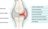 Top Benefits of Joint Genesis for Joint Pain Relief