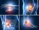 Top Insta Soothe Uses for Deep Tissue Pain