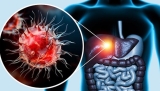 Top Products to Manage Fatty Liver Naturally
