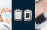 Xitox Foot Pads: An In-Depth Review
